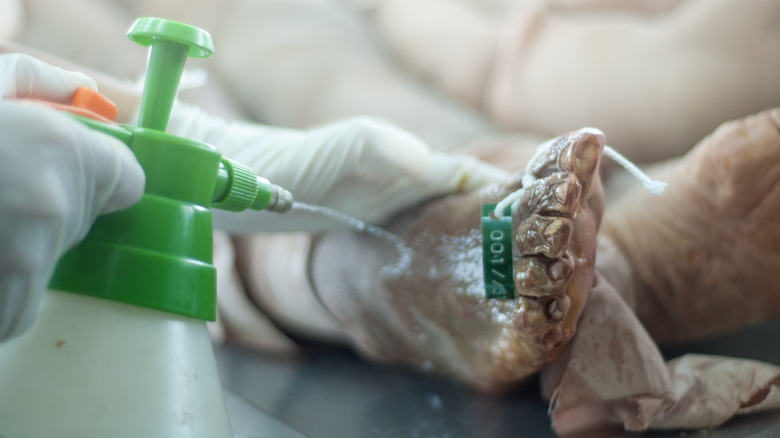 embalmer injects embalming fluid into corpse