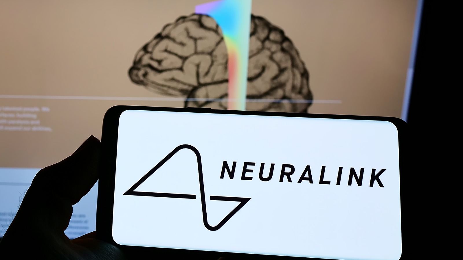 At Least 8 Monkeys Died During A Neuralink Experiment