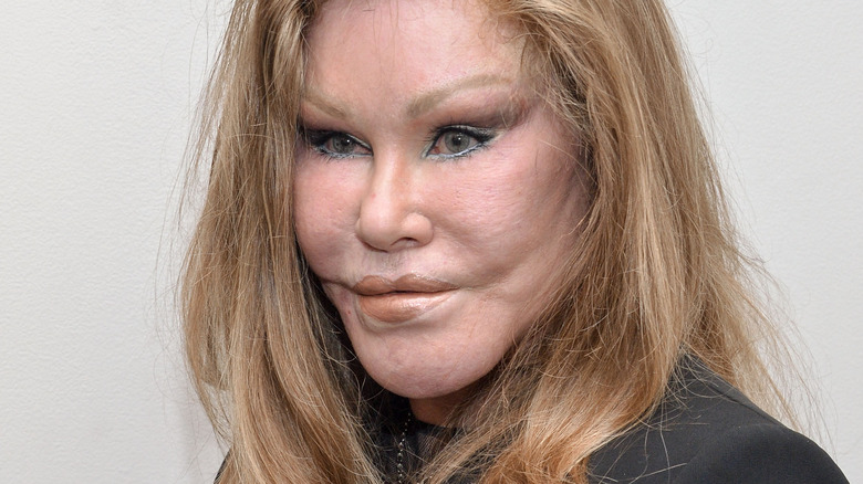 Jocelyn Wildenstein