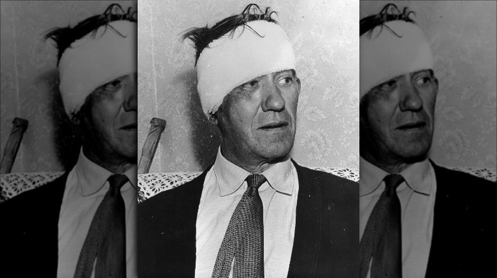 Train engineer Jack Mills with a bandage on his head