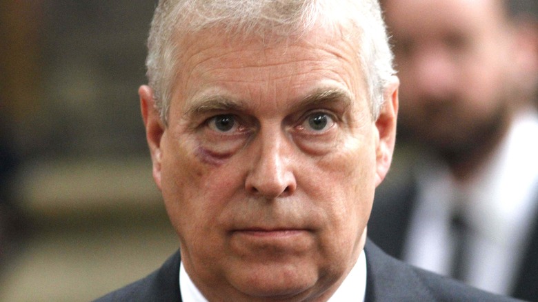 Prince Andrew wide eyed