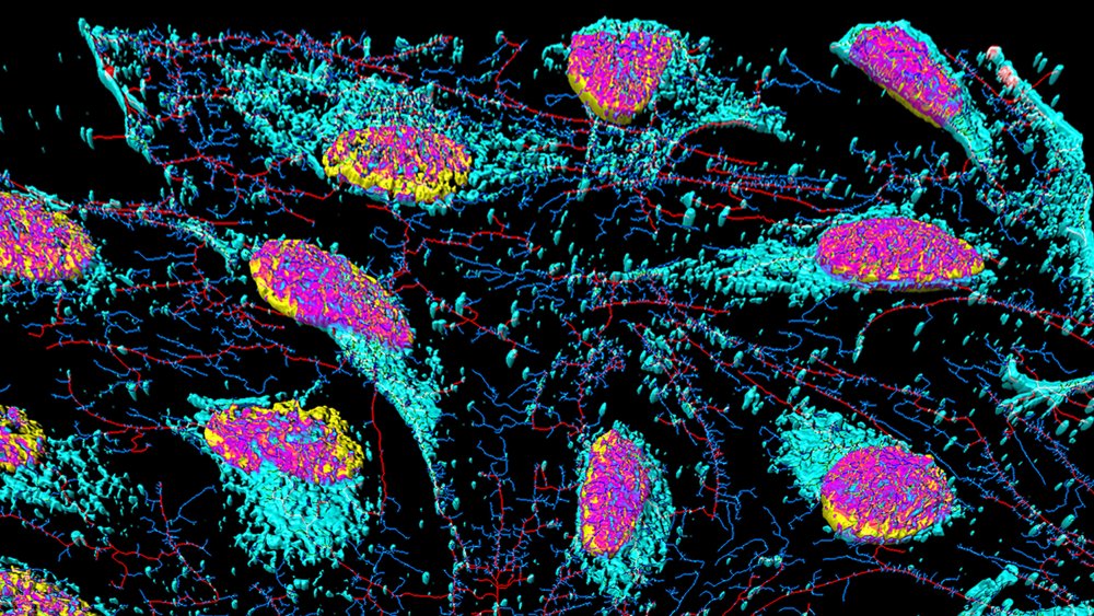 HeLa cells