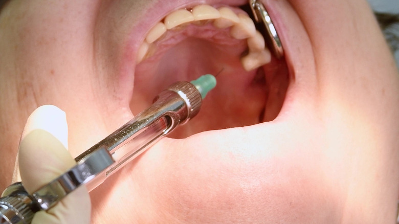 Dental injection being applied