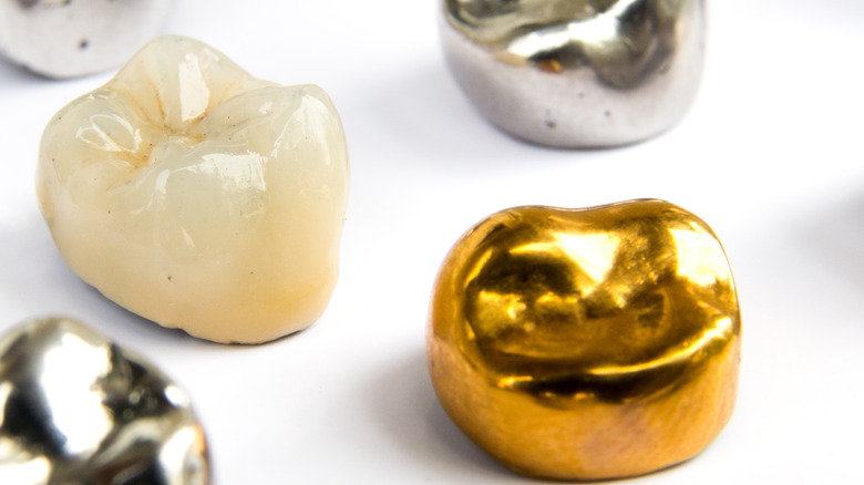 Ceramic and gold dental crowns