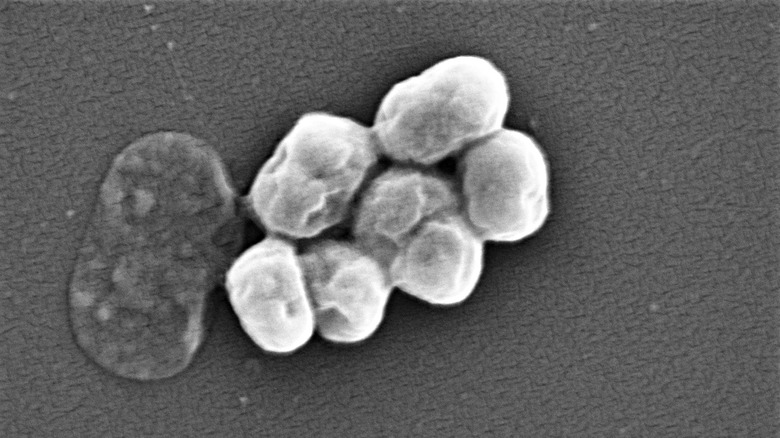 Acinetobacter baumannii 