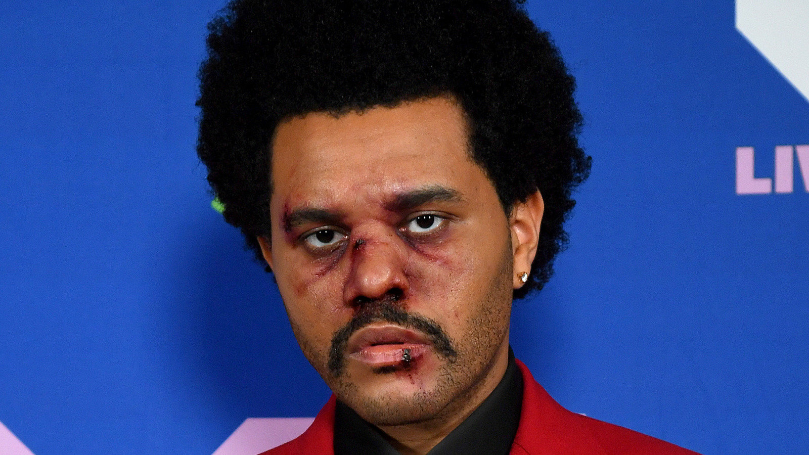 Did The Weeknd Get Plastic Surgery The Photo Explained Images And