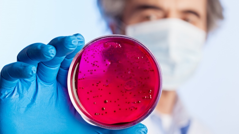 masked and gloved doctor holding petri dish