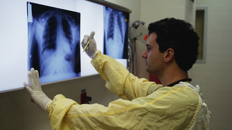 A doctor examining a chest x-ray