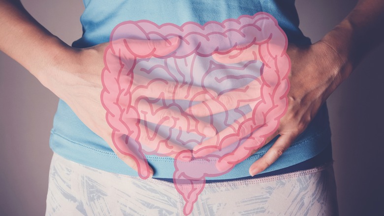 Intestinal overlay over gut