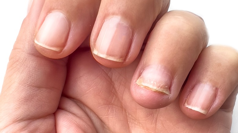 close-up shot of fingernails
