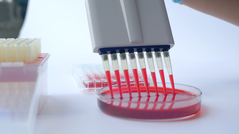 blood sample in a laboratory