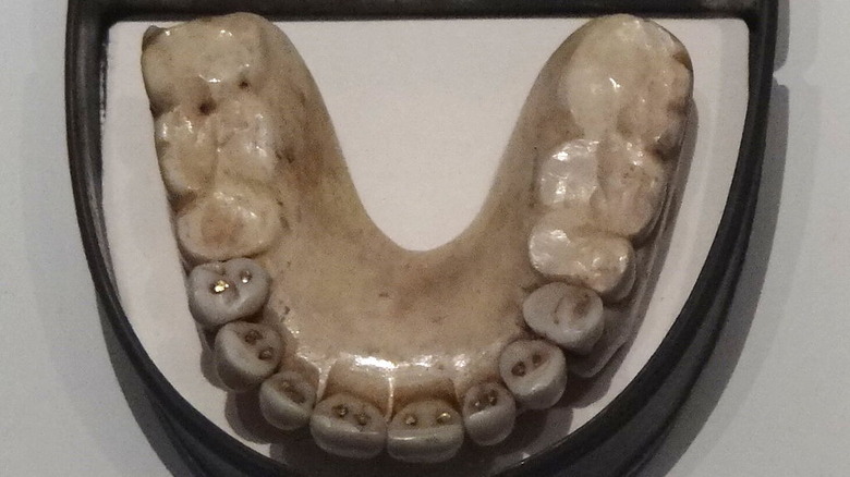 Waterloo Dentures