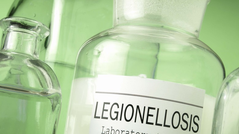 legionella lab sample