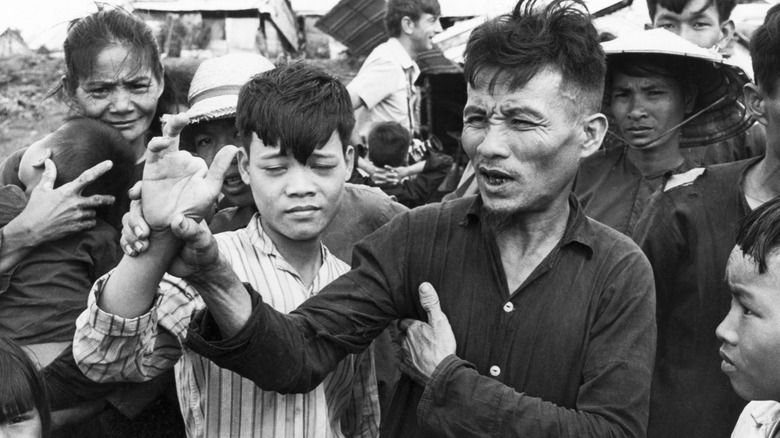Vietnamese civilians showing disfigured hand