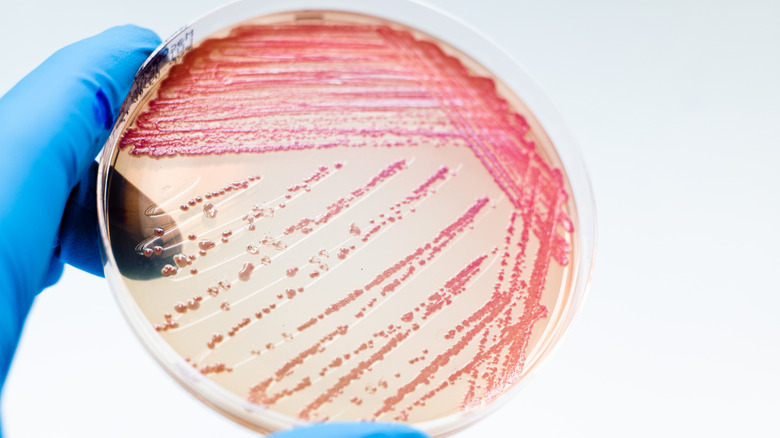 Burkholderia pseudomallei in a petri dish held by a technician 