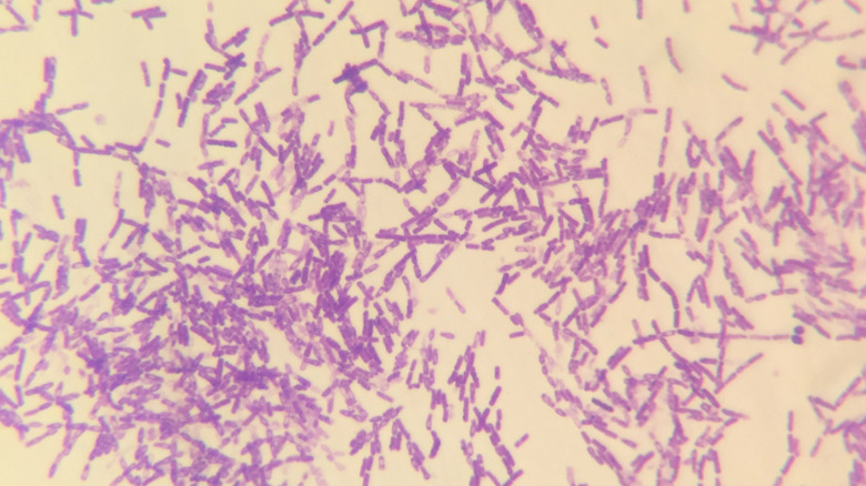 Bacillus anthracis, anthrax