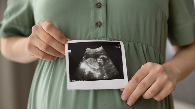 Women with ultrasound 