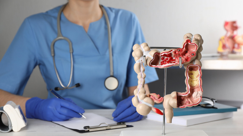 Doctor with colon model 