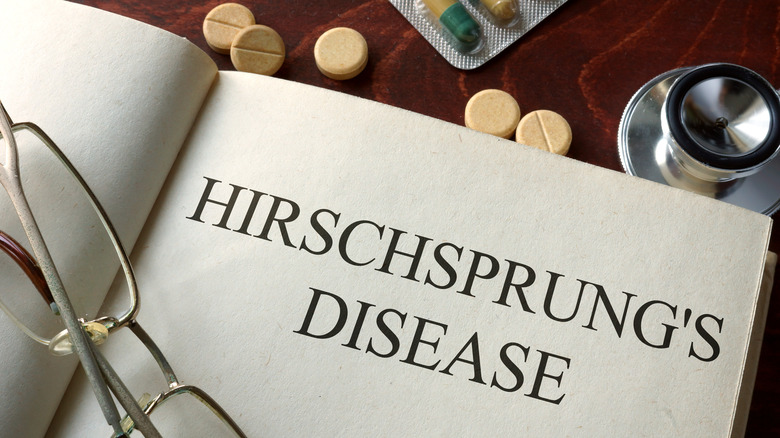 Hirschsprung's disease