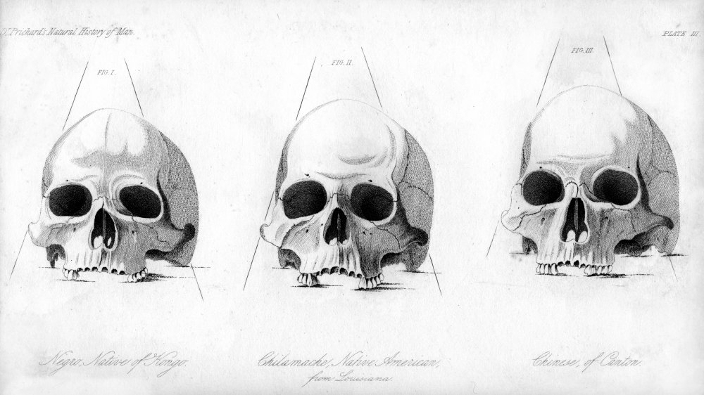 skull comparison