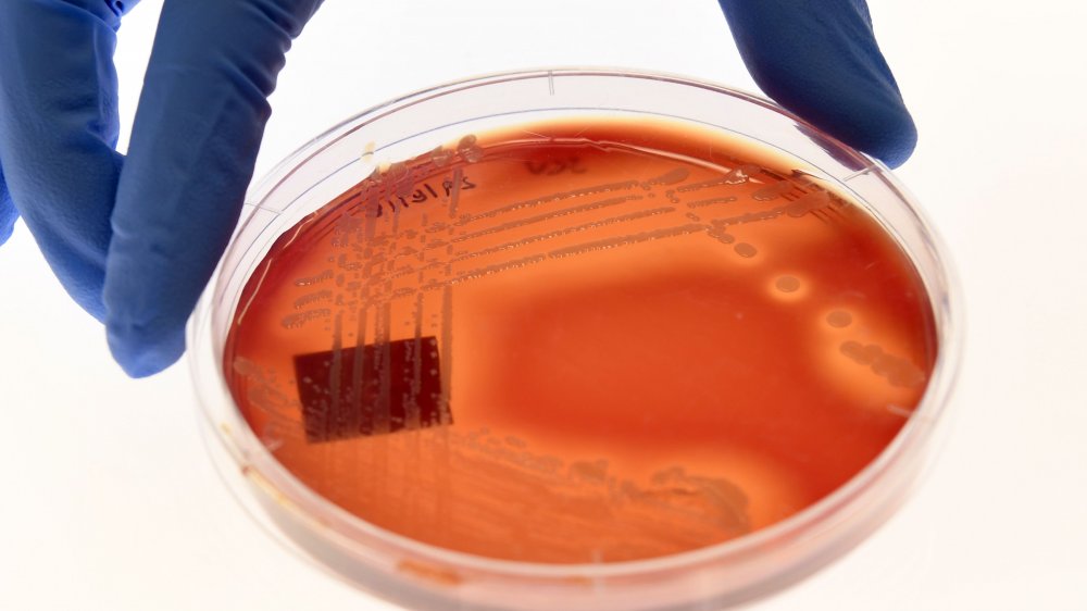 scientist handling petri dish of viruses