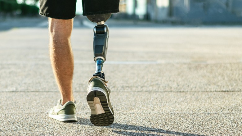 young man with prosthetic