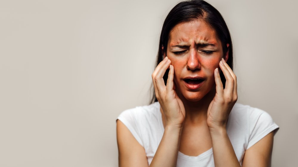 woman clutching face with red rash