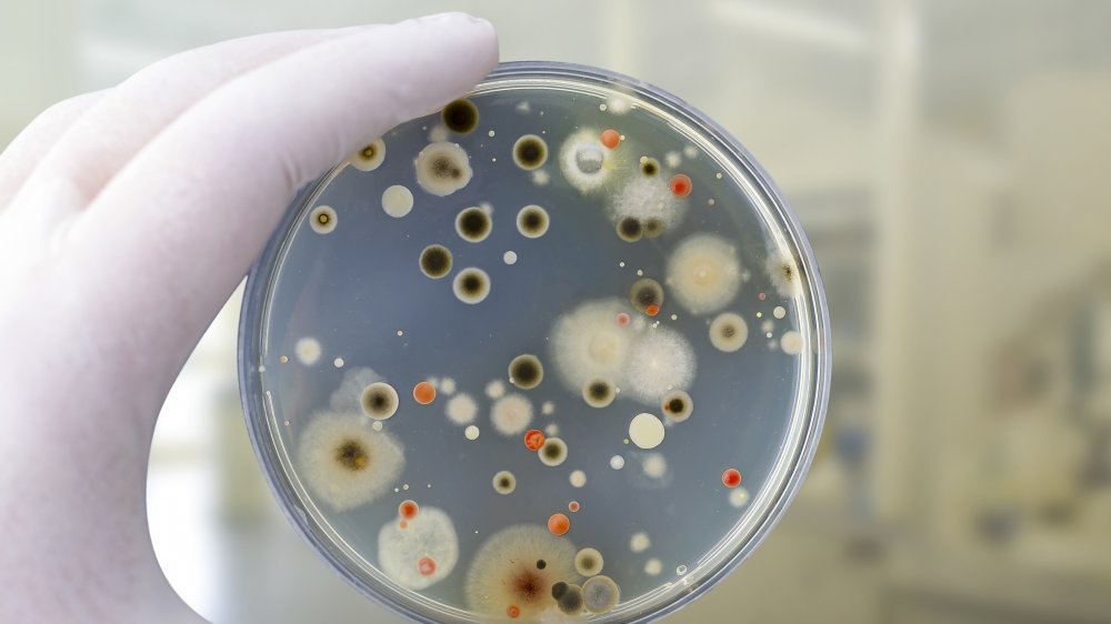 Colonies of different bacteria and mold fungi grown on Petri dish with nutrient agar, close-up view.