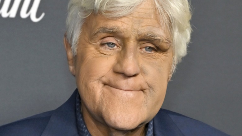 Jay Leno smirking with a black eye