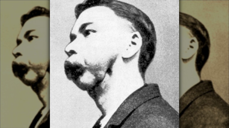 matchstick maker with phossy jaw