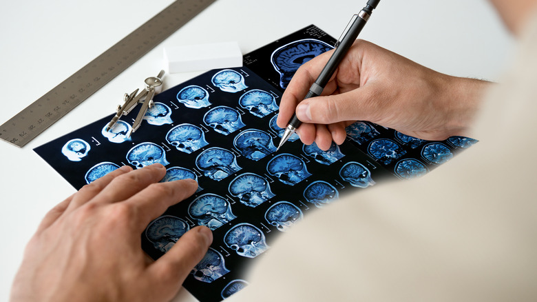 Man drawing on brain scans