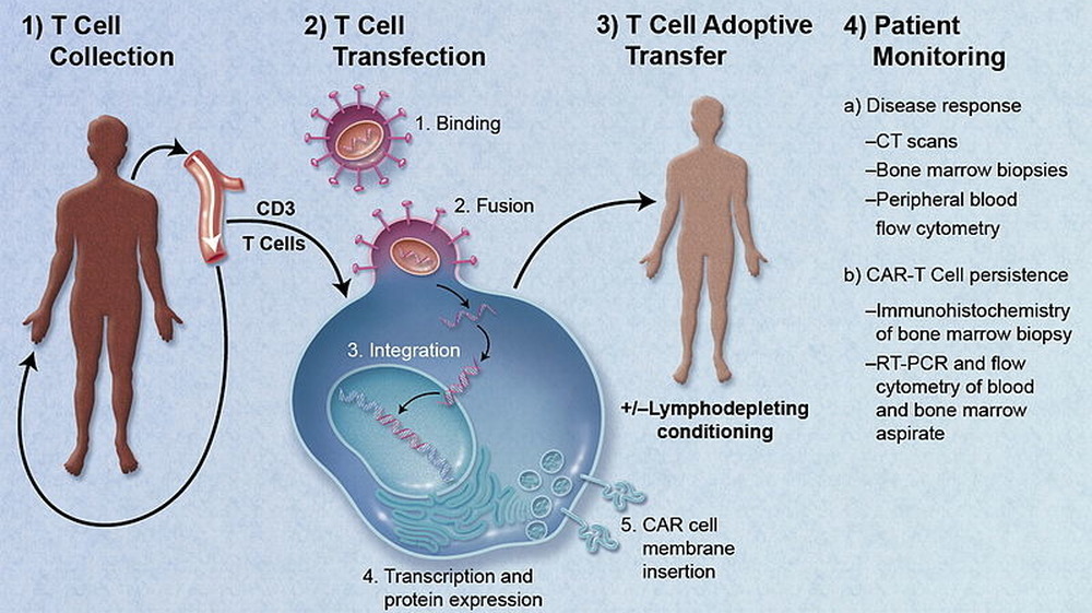 Depiction of adoptive cell therapy using CAR-modified T Cells