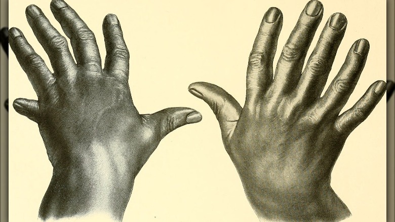 human hands with extra fingers