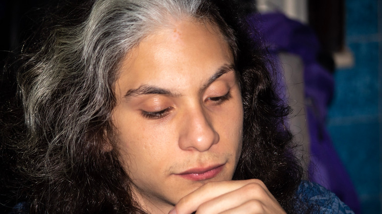 young man with white streak hair