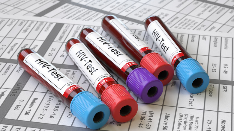 blood vials HIV test forms