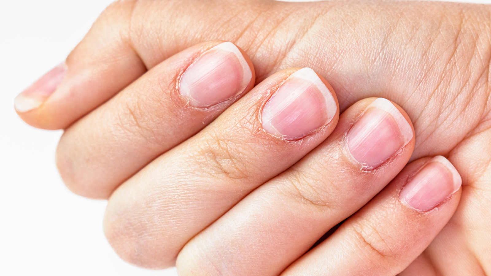 How Do Nails Grow Back? | What are Nails Made Of? | What is Keratin?