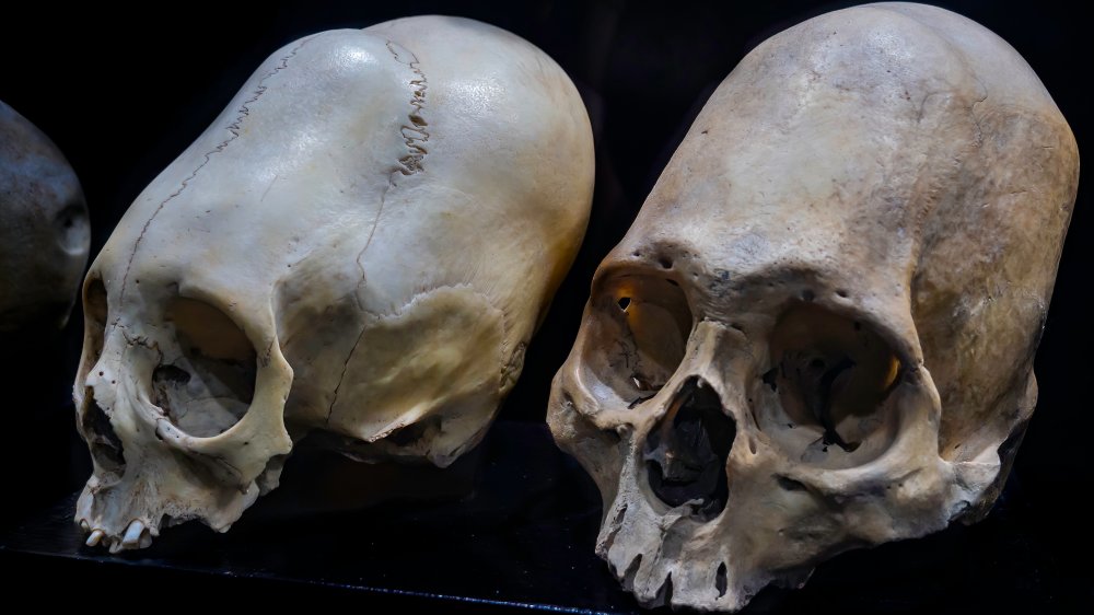 modified skulls