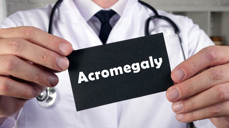 doctor holding acromegaly card