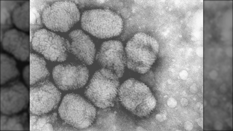 Electron micrograph of smallpox viruses