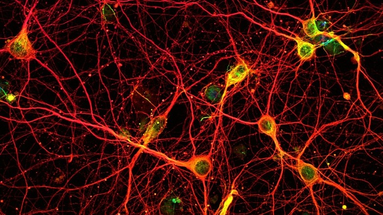 Human neurons