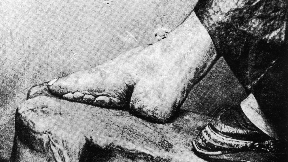 foot binding