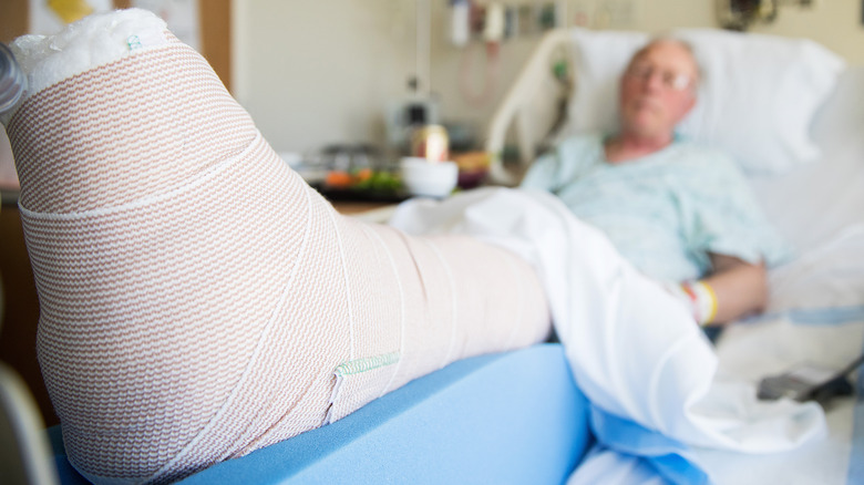 Man in hospital bed with broken leg