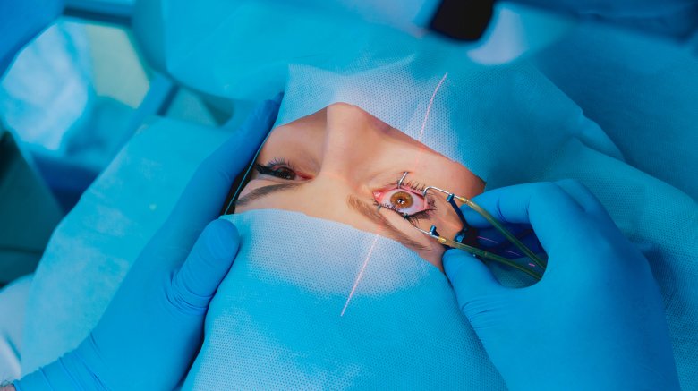 lasik surgery