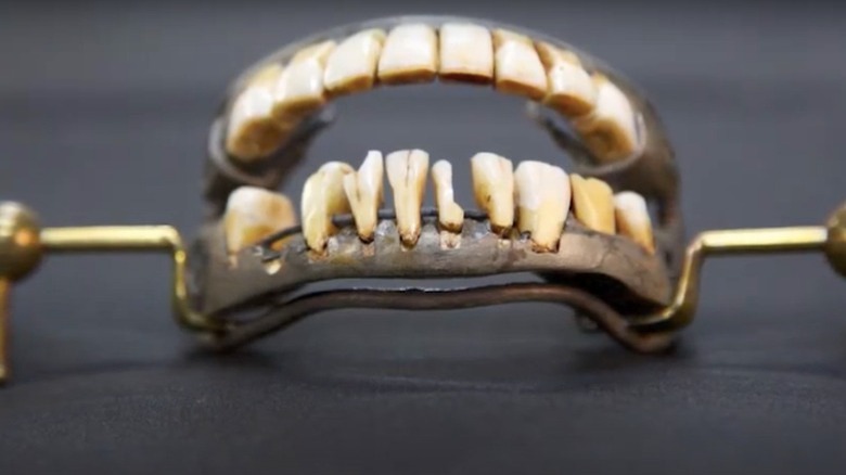 George Washington's teeth