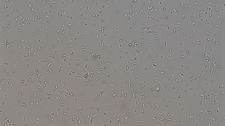 Microscope image of bacteria