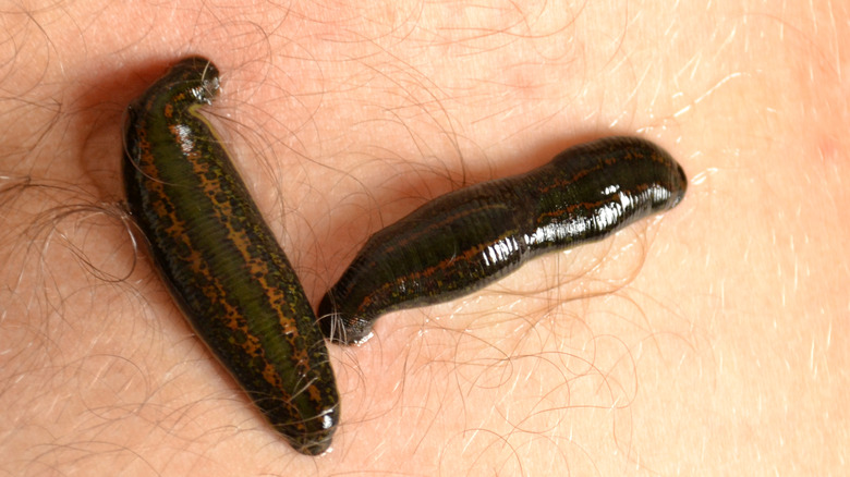 Leeches on skin