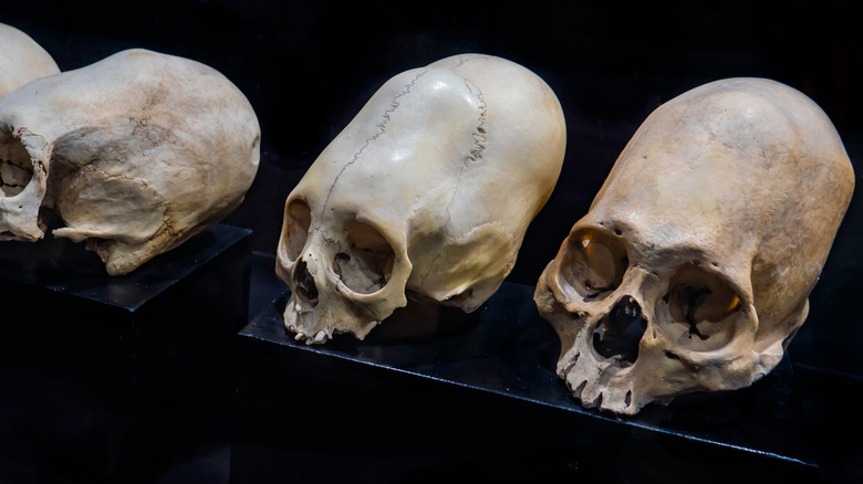 deformed Inca skulls