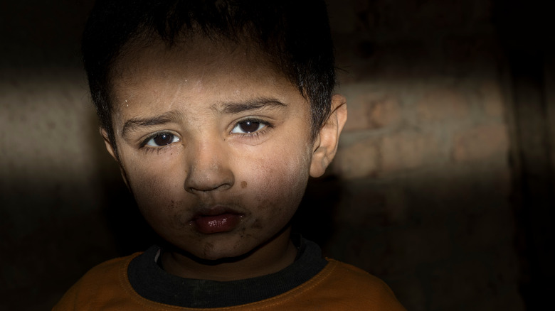 A photo of a child with a grim life.