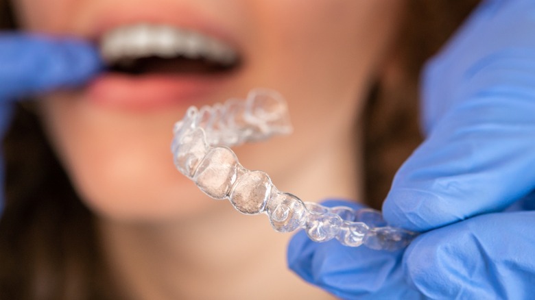 woman being fitted with invisible braces