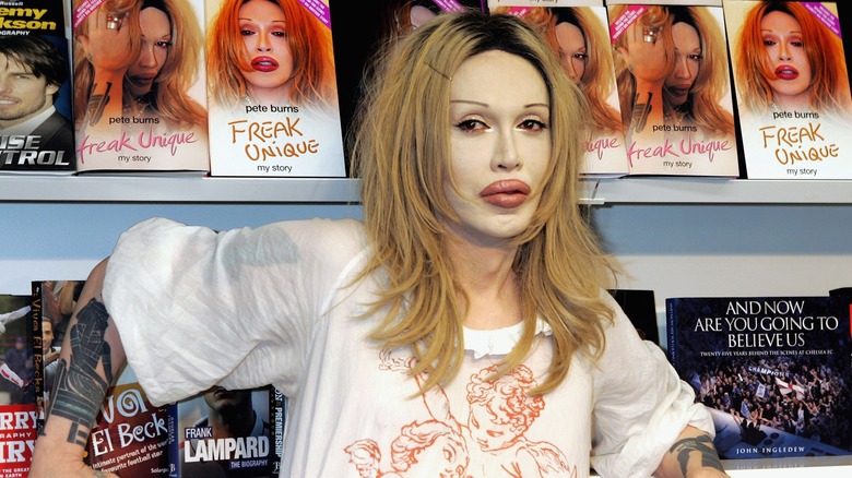 Pete Burns